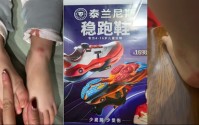 千元童鞋把脚穿肿？泰兰尼斯遭家长“围攻”，医生警惕影响发育，90%专利竟是外观设计